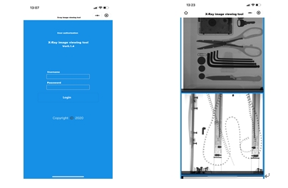 Intelligent Portable X-ray X-ray scanner